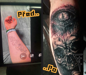 Předělávka předloktí, před a po.